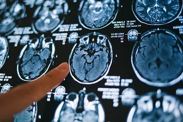 Pointing on magnetic resonance image MRI